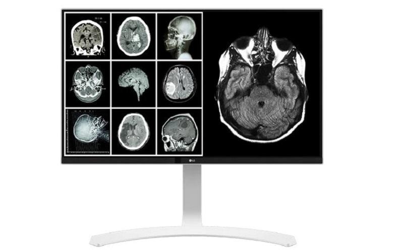Monitor LG 27